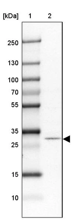 Lane 1: Marker [kDa] 250, 130, 100, 70, 55, 35, 25, 15, 10_br/_Lane 2: Human cell line SK-MEL-30
