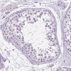 Immunohistochemical staining of human testis shows no positivity in cells in seminiferous ducts as expected.