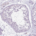 Immunohistochemical staining of human testis shows no positivity in cells in seminiferous ducts as expected.