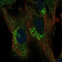 Anti-TREM1 Antibody