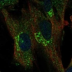 Anti-TREM1 Antibody