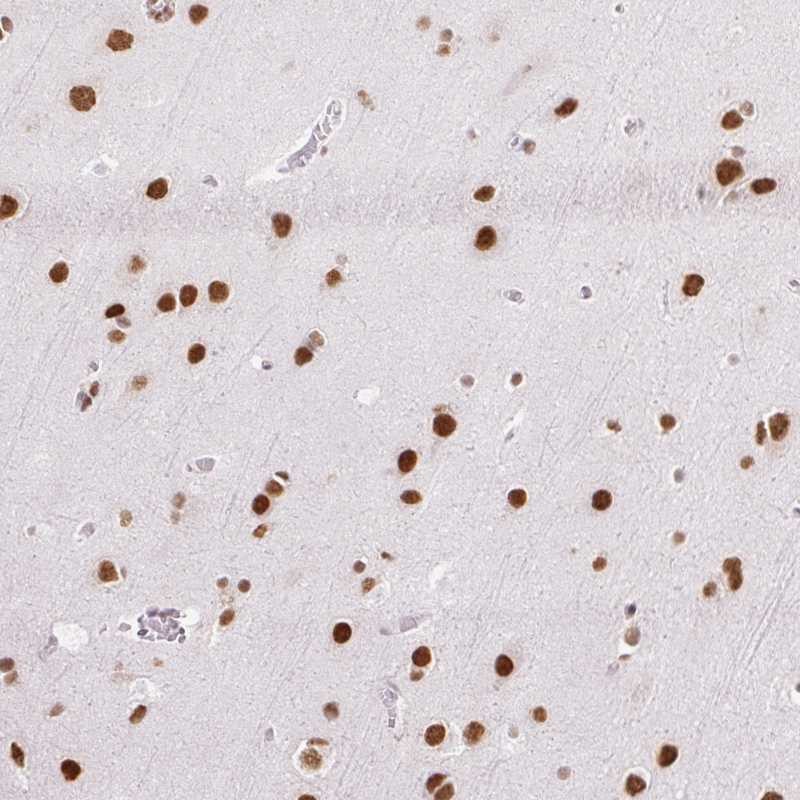 Anti-NPIPA1 Antibody