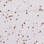 Anti-NPIPA1 Antibody