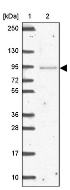 Lane 1: Marker [kDa] 250, 130, 95, 72, 55, 36, 28, 17, 10_br/_Lane 2: Human cell line RT-4