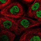 Immunofluorescent staining of human cell line A-431 shows localization to nucleoplasm.
