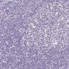 Immunohistochemical staining of human lymph node shows low expression as expected.