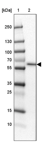 Lane 1: Marker [kDa] 250, 130, 100, 70, 55, 35, 25, 15, 10_br/_Lane 2: Human Kidney tissue
