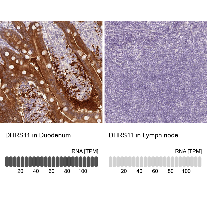 Anti-DHRS11 Antibody