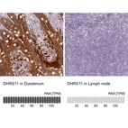 Anti-DHRS11 Antibody