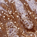 Immunohistochemical staining of human duodenum shows high expression.