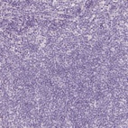 Immunohistochemical staining of human lymph node shows low expression as expected.