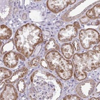 Anti-RPLP2 Antibody