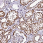 Anti-RPLP2 Antibody