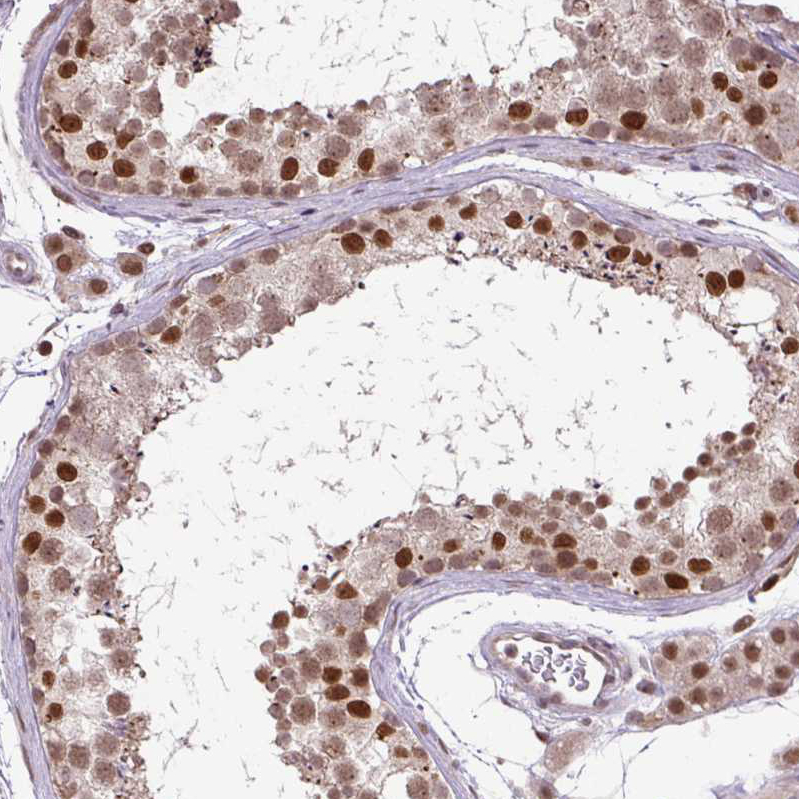 Anti-KPNA1 Antibody