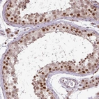 Anti-KPNA1 Antibody
