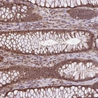 Immunohistochemical staining of human rectum shows strong nuclear positivity in glandular cells.