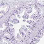Immunohistochemical staining of human prostate shows no nuclear positivity in glandular cells as expected.