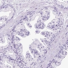 Immunohistochemical staining of human prostate shows no nuclear positivity in glandular cells as expected.