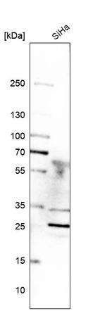 Western blot analysis in human cell line SiHa.