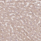 Immunohistochemical staining of human liver shows moderate granular cytoplasmic positivity in hepatocytes.