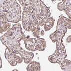 Immunohistochemical staining of human placenta shows moderate granular cytoplasmic positivity in trophoblastic cells.