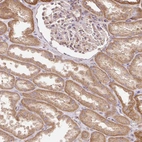 Immunohistochemical staining of human kidney shows moderate granular cytoplasmic positivity in cells in tubules.