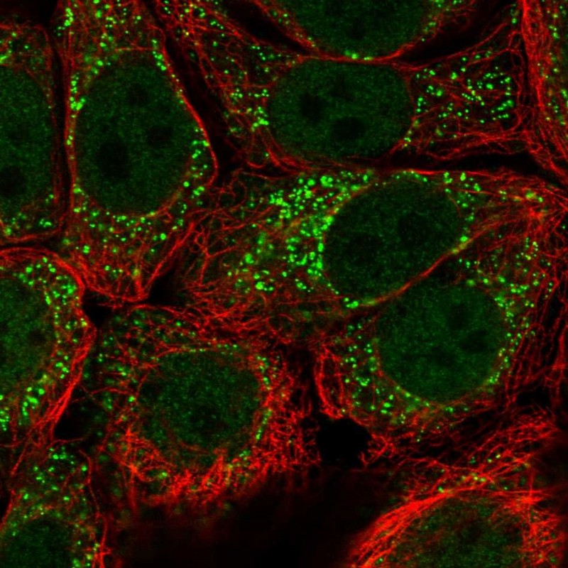 Anti-URM1 Antibody
