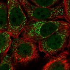 Anti-URM1 Antibody