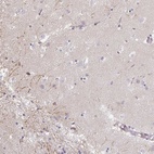 Anti-IP6K3 Antibody