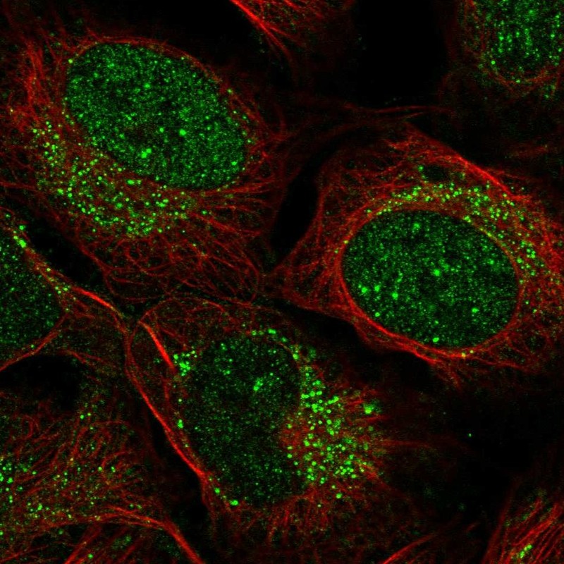 Anti-ZADH2 Antibody