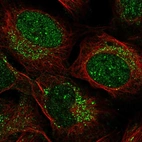 Anti-ZADH2 Antibody