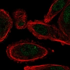 Immunofluorescent staining of human cell line PC-3 shows localization to nucleoplasm.