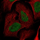 Anti-NRDC Antibody
