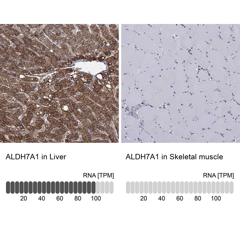 Anti-ALDH7A1 Antibody
