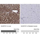 Anti-ALDH7A1 Antibody