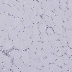 Immunohistochemical staining of human skeletal muscle shows low expression as expected.