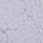 Anti-ALDH7A1 Antibody