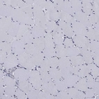 Immunohistochemical staining of human skeletal muscle shows low expression as expected.