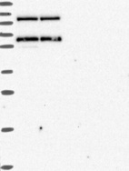 Anti-ALDH7A1 Antibody