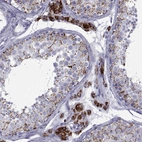 Immunohistochemical staining of human testis shows strong granular cytoplasmic positivity in Leydig cells.