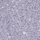 Immunohistochemical staining of human liver shows no positivity in hepatocytes as expected.