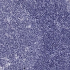 Immunohistochemical staining of human lymph node shows no positivity in non-germinal center cells as expected.