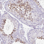 Immunohistochemical staining of human testis shows strong cytoplasmic positivity in pachytene spermatocytes and round spermatids.