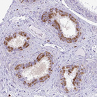 Immunohistochemical staining of human epididymis shows strong cytoplasmic positivity in a subset of glandular cells.