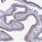 Immunohistochemical staining of human fallopian tube shows moderate cytoplasmic positivity in a subset of glandular cells.