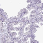 Immunohistochemical staining of human prostate shows no cytoplasmic positivity in glandular cells as expected.