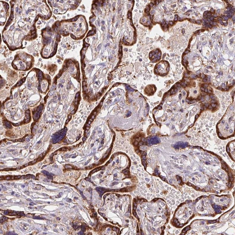 Anti-KLHL20 Antibody