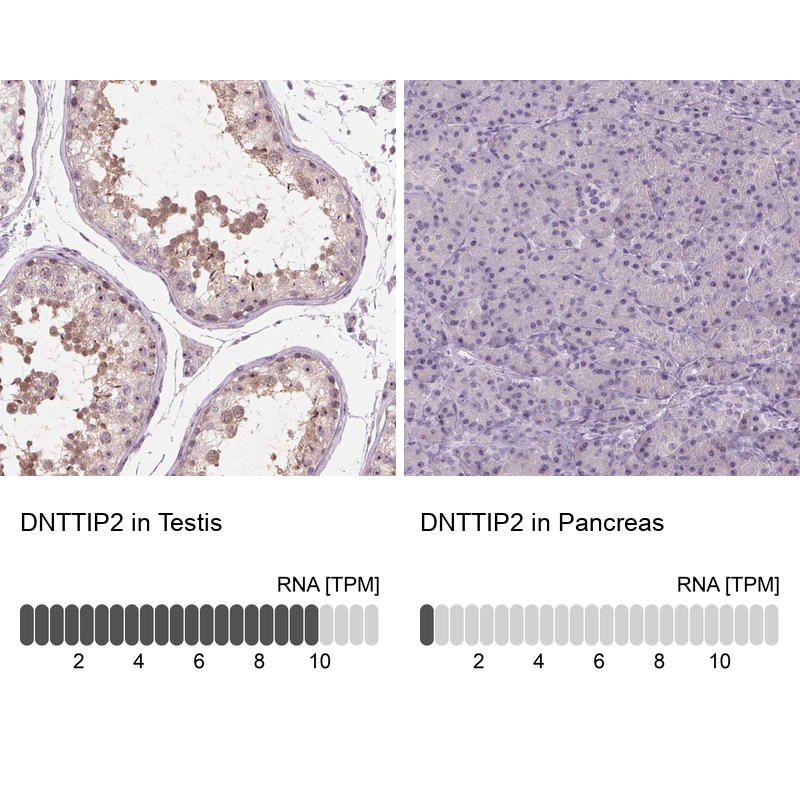 Anti-DNTTIP2 Antibody