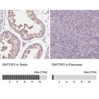Anti-DNTTIP2 Antibody