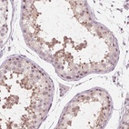 Immunohistochemical staining of human testis shows high expression.